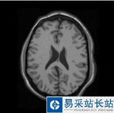 Python可視化mhd格式和raw格式的醫(yī)學(xué)圖像并保存