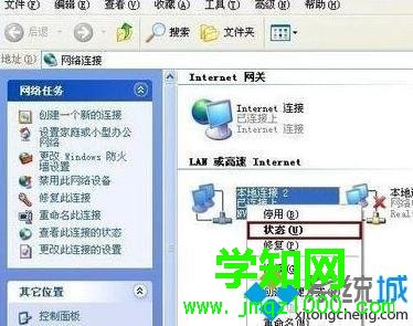 XP系統服務器dns如何設置最好