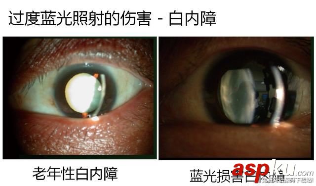 護(hù)眼顯示器