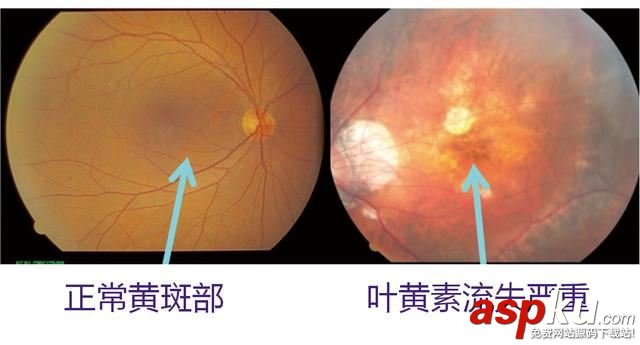 護(hù)眼顯示器