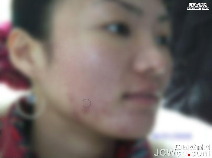 練就網(wǎng)絡(luò)美女 ps完美除痘痘磨皮教程_網(wǎng)頁設(shè)計