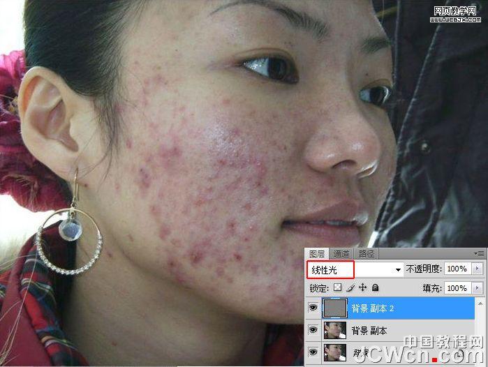 練就網(wǎng)絡(luò)美女 ps完美除痘痘磨皮教程_網(wǎng)頁設(shè)計